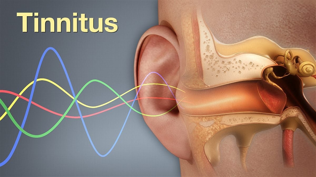 Illustration of sound waves entering the ear